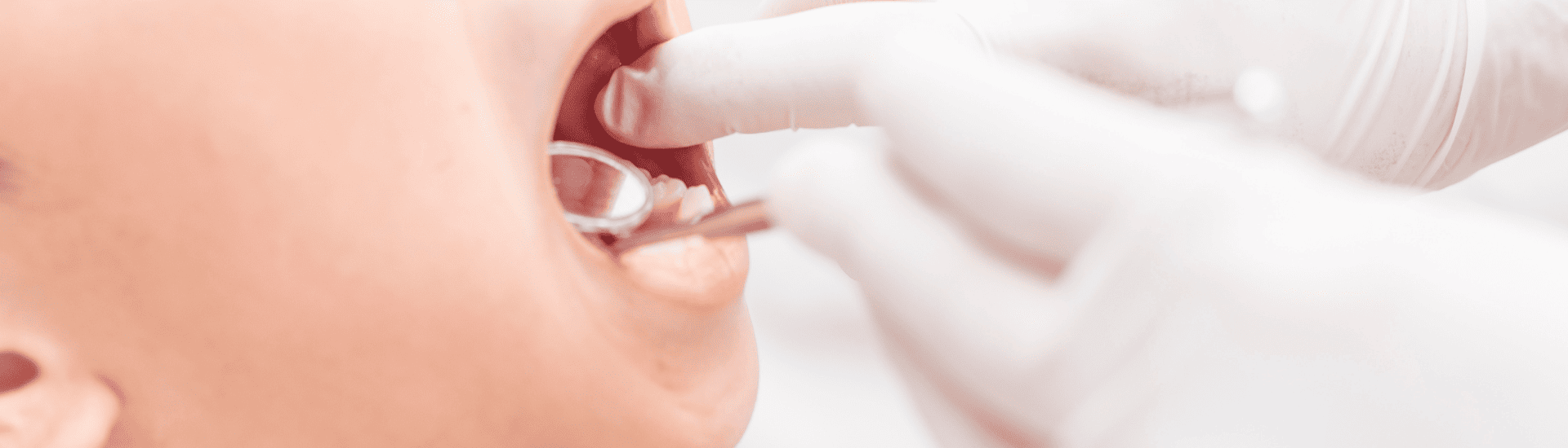 小児歯科｜古屋歯科