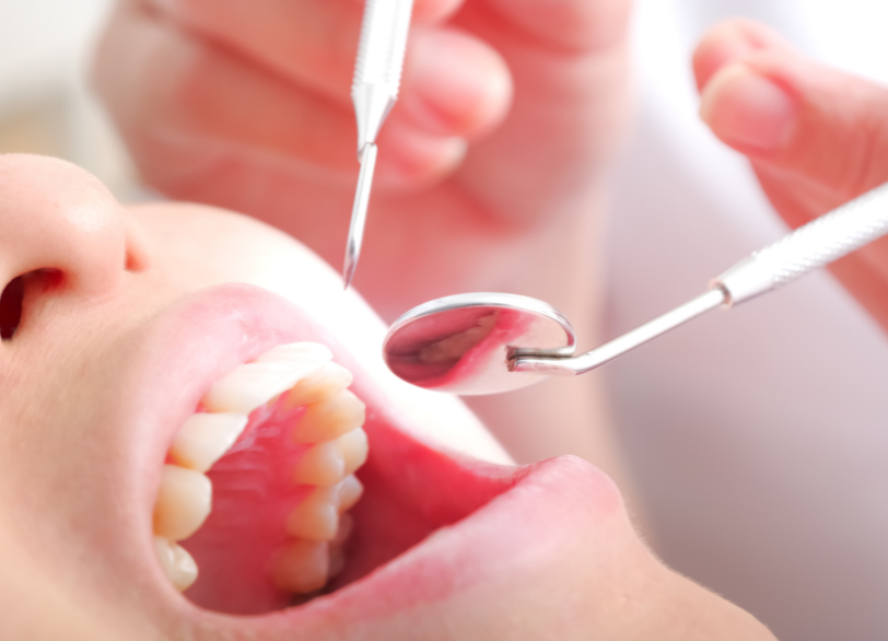 治療前の準備｜古屋歯科