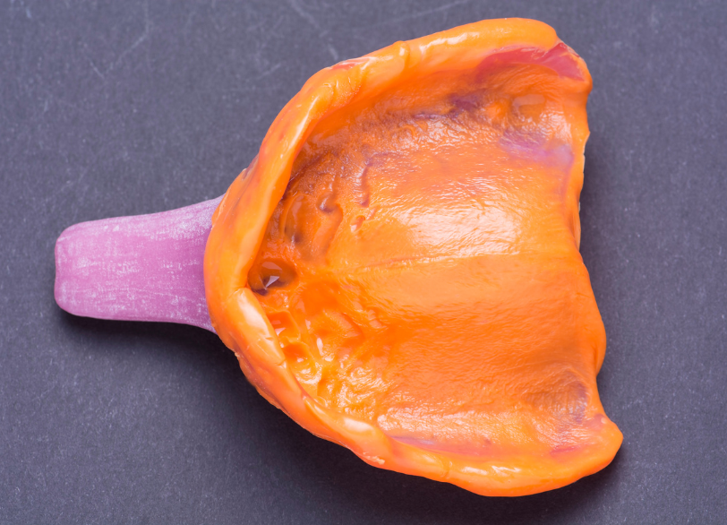 個人トレー｜古屋歯科