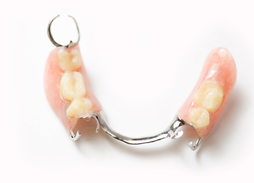 入れ歯治療｜古屋歯科