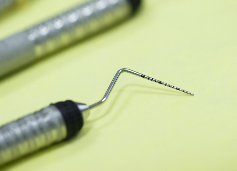 歯周病｜古屋歯科