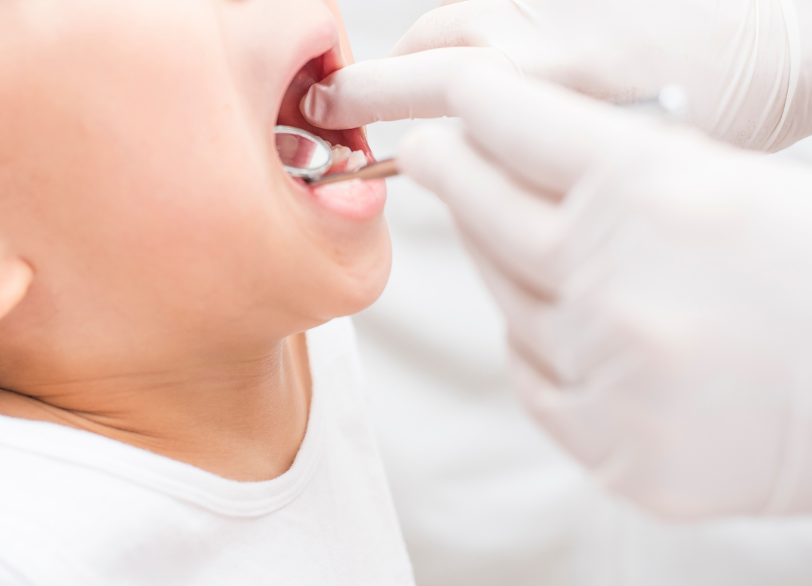 小児歯科｜古屋歯科