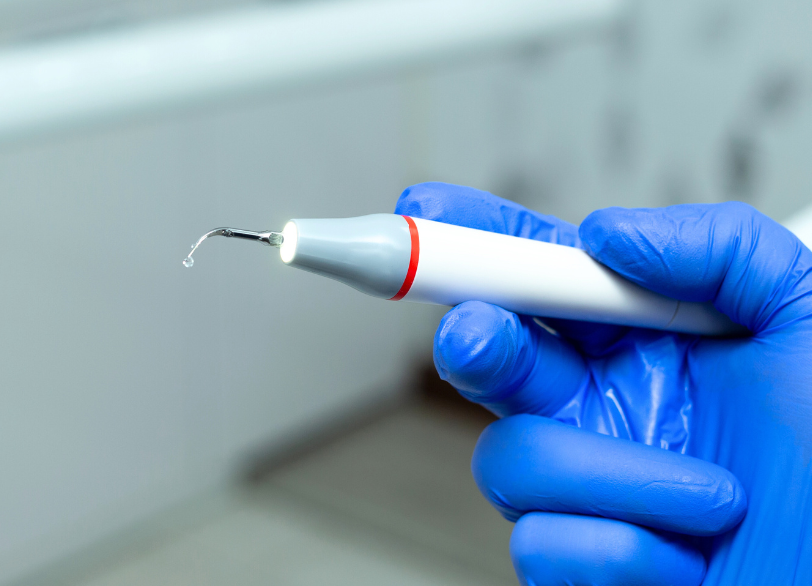 歯石の除去（スケーリング）｜古屋歯科